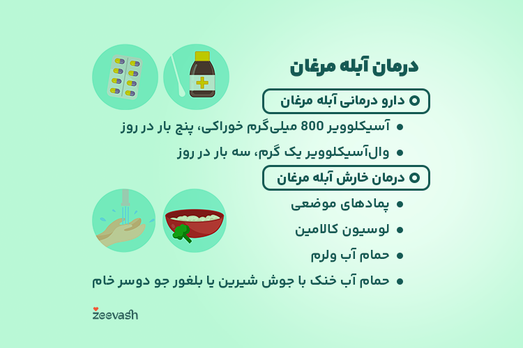 درمان آبله مرغان